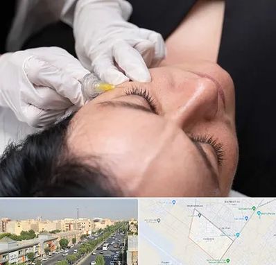 کربوکسی تراپی در کیانمهر کرج