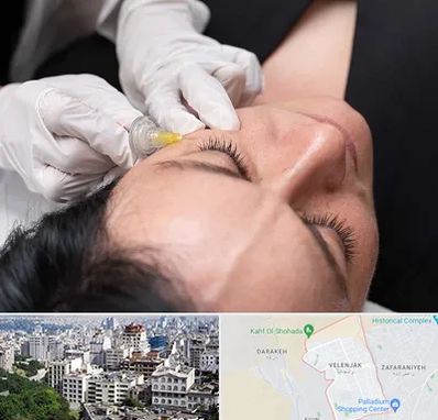 کربوکسی تراپی در ولنجک 