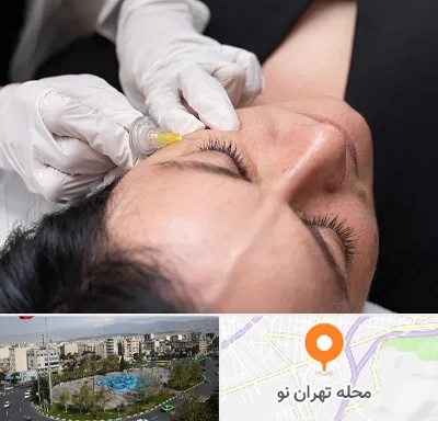 کربوکسی تراپی در تهران نو