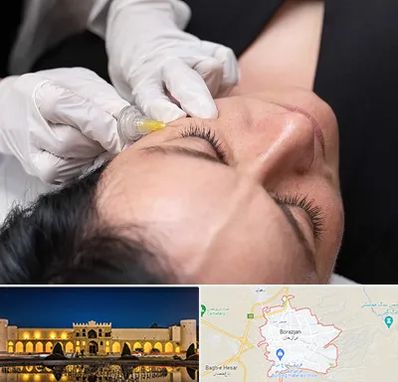 کربوکسی تراپی در برازجان