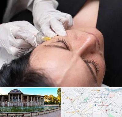 کربوکسی تراپی در عفیف آباد شیراز