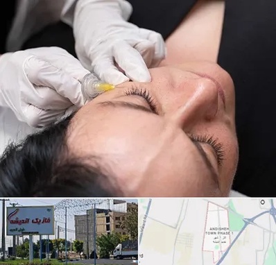 کربوکسی تراپی در فاز یک اندیشه