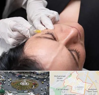 کربوکسی تراپی در فردیس کرج 