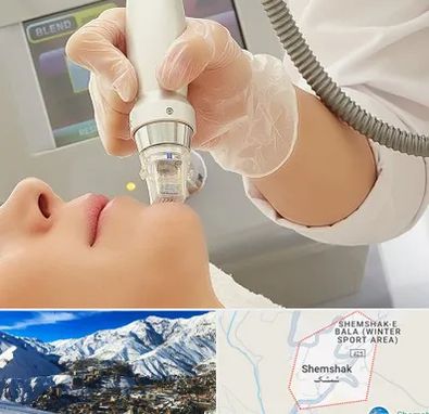 آر اف فرکشنال در شمشک