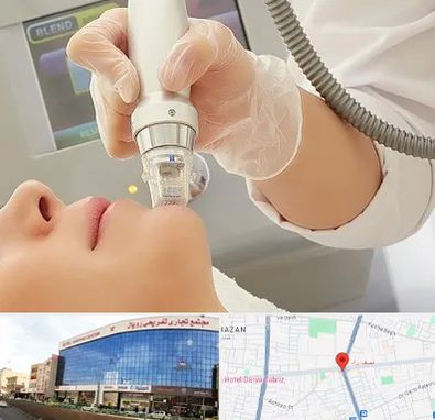 آر اف فرکشنال در نصف راه تبریز