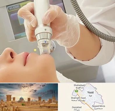 آر اف فرکشنال در یزد