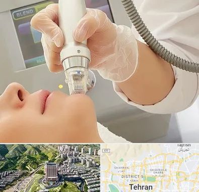 آر اف فرکشنال در شمال تهران 