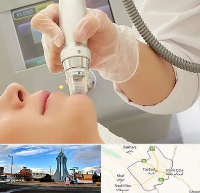 آر اف فرکشنال در تایباد