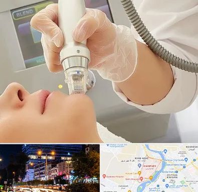 آر اف فرکشنال در کیانپارس اهواز