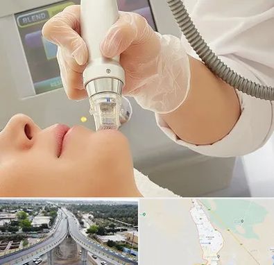 آر اف فرکشنال در اندیمشک