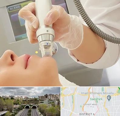 آر اف فرکشنال در یوسف آباد 