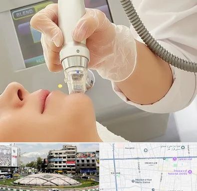 آر اف فرکشنال در مرکز تهران