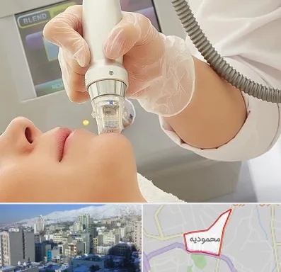 آر اف فرکشنال در محمودیه
