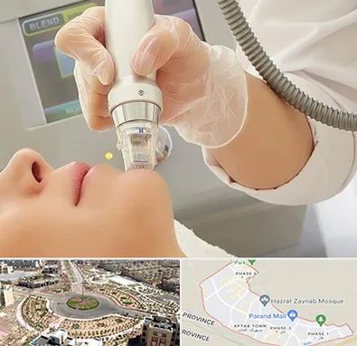 آر اف فرکشنال در پرند