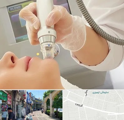 آر اف فرکشنال در خیابان قزوین