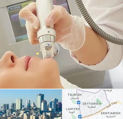 آر اف فرکشنال در قیطریه 