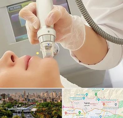 آر اف فرکشنال در منطقه 1 تهران 