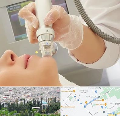 آر اف فرکشنال در محلاتی شیراز