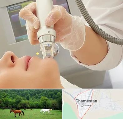 آر اف فرکشنال در چمستان