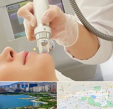 آر اف فرکشنال در منطقه 22 تهران 