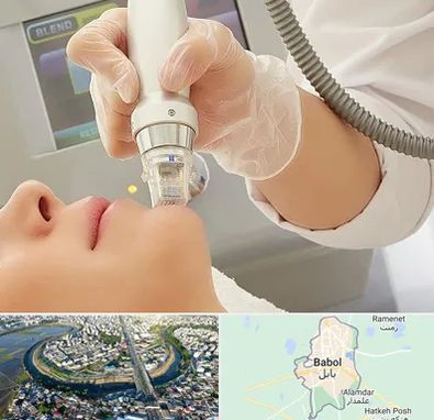 آر اف فرکشنال در بابل