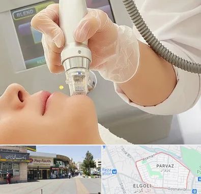 آر اف فرکشنال در پرواز تبریز