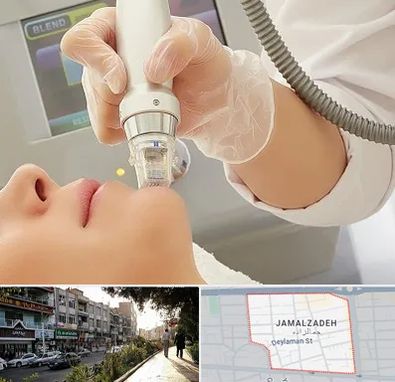 آر اف فرکشنال در خیابان جمالزاده