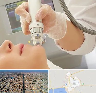 آر اف فرکشنال در بندر ماهشهر