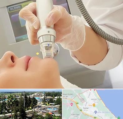 آر اف فرکشنال در رودسر