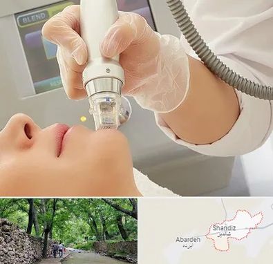 آر اف فرکشنال در شاندیز مشهد