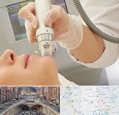 آر اف فرکشنال در منطقه 10 تهران 