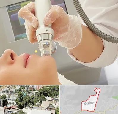 آر اف فرکشنال در جماران