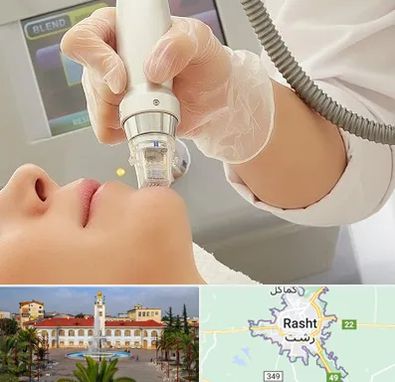 آر اف فرکشنال در رشت