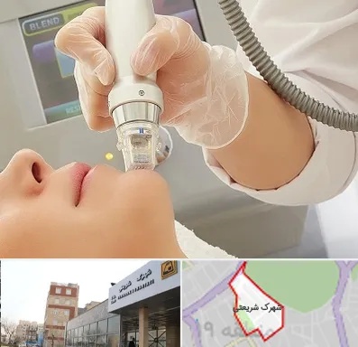 آر اف فرکشنال در شهرک شریعتی