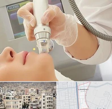 آر اف فرکشنال در اسکندری