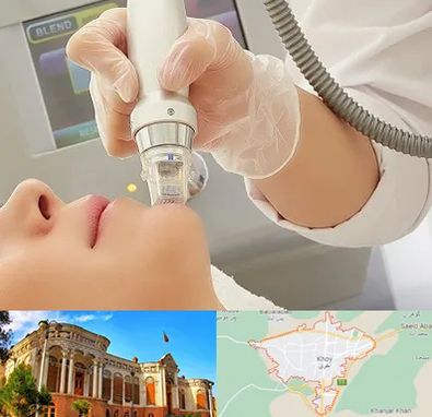 آر اف فرکشنال در خوی