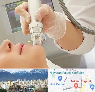 آر اف فرکشنال در آجودانیه 