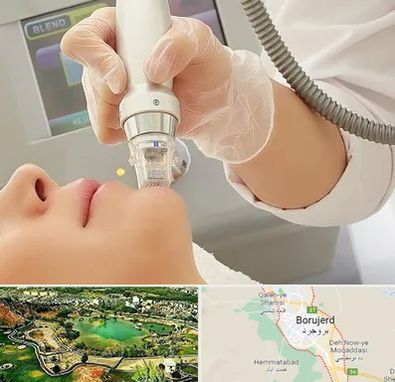 آر اف فرکشنال در بروجرد