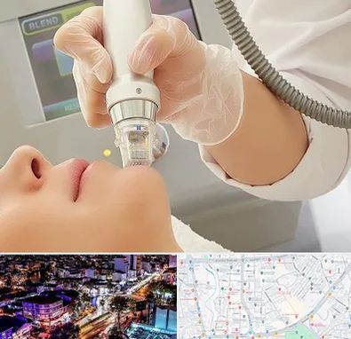 آر اف فرکشنال در منظریه رشت