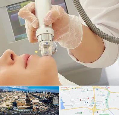 آر اف فرکشنال در شهرک راه آهن