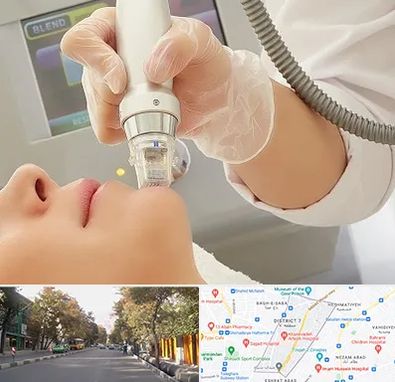 آر اف فرکشنال در شریعتی 