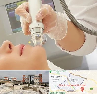 آر اف فرکشنال در حکیمیه 