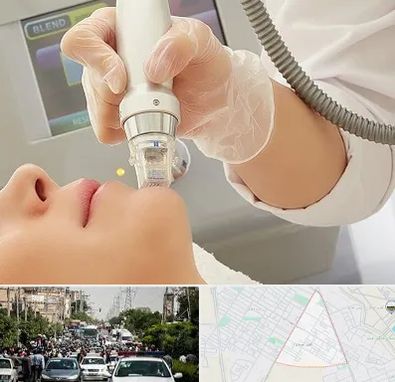 آر اف فرکشنال در سیدی مشهد