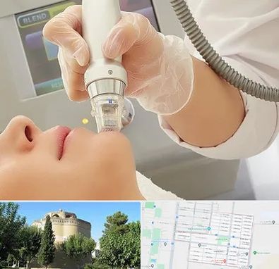 آر اف فرکشنال در مرداویج اصفهان