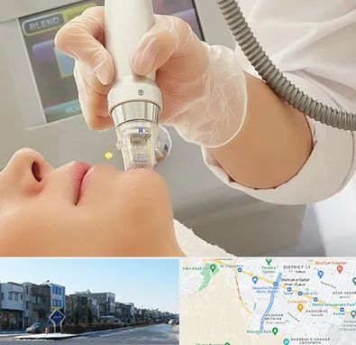 آر اف فرکشنال در شریعتی مشهد