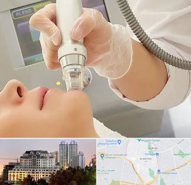 آر اف فرکشنال در فرشته 