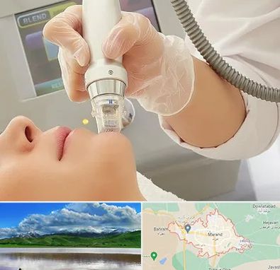 آر اف فرکشنال در مرند