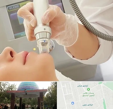 آر اف فرکشنال در کیانشهر