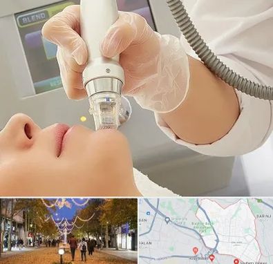 آر اف فرکشنال در ولیعصر ارومیه