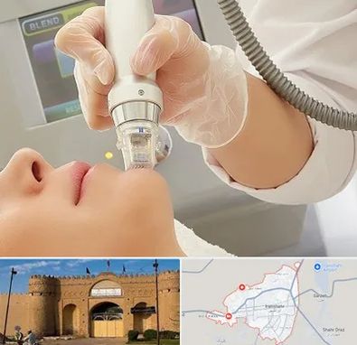 آر اف فرکشنال در ایرانشهر